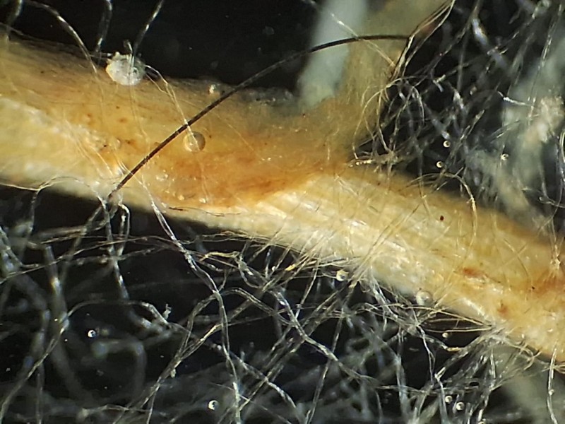 Hifas de fungo micorrízico arbuscular em simbiose com raízes de soja